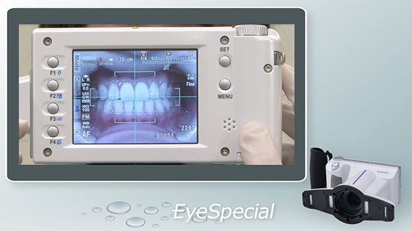EyeSpecial Instructional Video