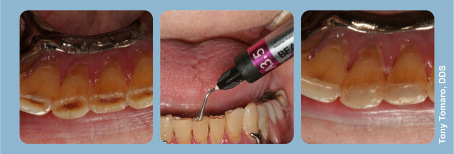 IEW clinical pictures